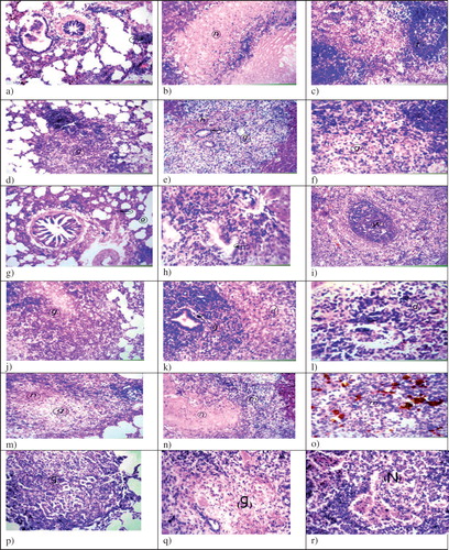 Figure 6. Histopathological examination of guinea pigs organs infected and differently treated (H&E, ×40), (a) Lung infected and treated with free ethambutol hydrochloride 6 days weekly for 6 weeks, show focal lymphoid cells aggregation (arrow) and diffuse lymphoid cells infiltration in between the air alveoli, (b) Livers show wide circumscribed area of necrosis replacing the hepatic parenchyma (n), (c) Spleens show mild depletion in central portion of the white pulp (f), (d) Lungs infected and treated with free ethambutol hydrochloride twice weekly for 6 weeks, show granuloma formation mainly cellular (g) with central necrosis, (e) Livers show granuloma formation (g) with haemorrhages (h) and hyperplasia in bile duct (arrow), (f) Spleens show the necrosis in the lymphoid cells in the center of the white pulps (g), (g) Lungs infected and treated with ethambutol hydrochloride niosomes (1:1:0.1 negative) (F2) twice weekly for 6 weeks, show collapse (arrow) and emphysema (e) in air alveoli, (h) Livers show hyperplasia in bile duct (arrow) in the portal area, (i) Spleens show intact white pulp (w) with hemosiderosis in red pulp, (j) Lungs infected and treated with ethambutol hydrochloride niosomes (4:2 neutral) (F4) twice weekly for 6 weeks, show cellular granuloma with central necrosis (g) replacing the lung parenchyma, (k) Livers show granuloma formation mainly from lymphoid cells (g) with hyperplasia in bile duct (arrow) and degeneration in other hepatocytes (d), (l) Spleens show lymphoid cellular necrosis in the white pulp (d), (m) Lungs of the control group infected and receiving saline, show granuloma with central necrosis replacing the lung parenchyma (g, n), (n) Livers show necrosis in the central zone of the granuloma (n) surrounded by other leucocytes (m), (o) Spleens show diffuse proliferation of epitheloid cells (m) with necrobiosis in the lymphoid cells and diffuse hemosiderosis (h), (p) Lungs of the control group infected and receiving neutral drug-free niosomes of the molar ratio Span 60: cholesterol (4:2), show cellular granuloma formation without central necrosis (g), (q) Livers show granuloma formation with central necrosis without fibrous connective tissue capsule formation (g) and (r) Spleens show cellular granuloma formation with central necrosis (N).