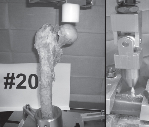 Figure 1. Material testing. A. Pauwels III fracture of a human cadaveric specimen after axial loading. The bone was fixed in a metal cylinder. Axial compression was performed via an artificial acetabulum. B. Osteosynthesis failure after pullout testing of a cortex screw.