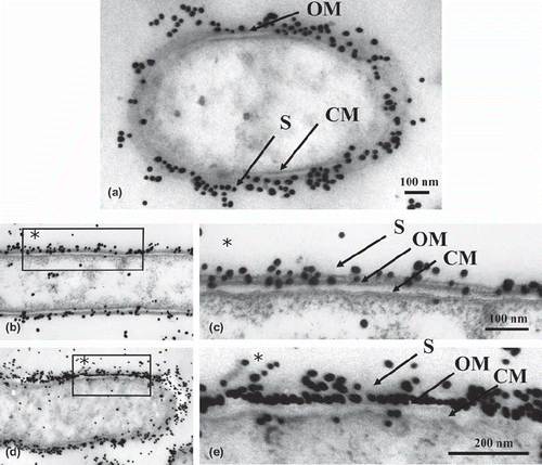 Fig. 2. Low (b, d) and high (a, c, e) magnification micrographs of immunogold-labeled T. forsythensis cells after antigen retrieval by heating with the autoclave. a) Autoclaved at 115˚ C with 1% citraconic anhydride. b and c) Autoclaved at 132˚ C with distilled water. d and e) Autoclaved at 132˚ C with 1% citraconic anhydride. Moderately decreased cytoplasm (a, b, d) compared to control cytoplasm (Fig. 1) without damage to the ultrastructural integrity of the cytoplasmic membrane and outer membrane (c, e). Immunogold-particles in a, c, e showed greater reactivity than the control (Fig. 1). CM, cytoplasmic membrane; OM, outer membrane; S, S-layer.