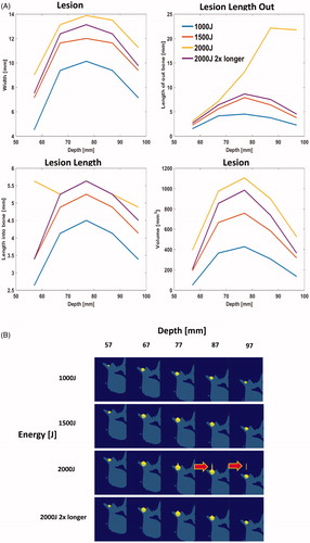 Figure 11. (A) Lesion dimensions as a as a function of depth for various energy levels. (B) Images of lesions and bone for the scenarios tested. Arrows point out conditions with secondary lesions. Because of secondary lesions we tested 2× longer sonication duration (on next page).