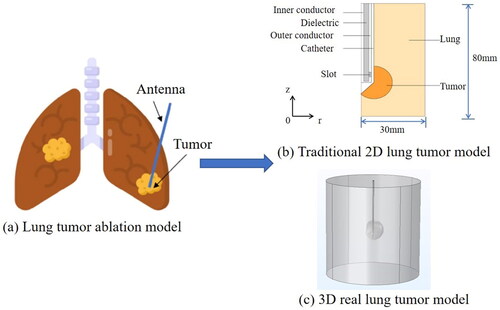 Figure 4. Lung tumor model. (a) Whole lung tissue-level model. (b) Traditional spherical tumor model. (c) Real tumor model based on CT slice.
