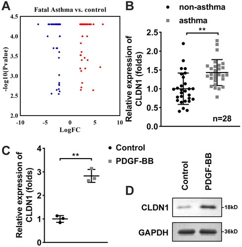 Figure 1. CLDN1 is highly expressed in patients with asthma and PDGF-BB-treated ASMCs. (A) Differentially expressed genes in ASM of patients with fatal asthma and control donors were predicted using microarray. CLDN1 expression in (B) serum samples of patients with asthma and (C) ASMCs treated with PDGF-BB evaluated by RT-qPCR. (D) Protein levels of CLDN1 in ASMCs measured by western blot. All experiments were repeated three times except for the detection of CLDN1 expression in serum samples (n = 28). Data are shown as mean ± standard deviation. **p < 0.01.