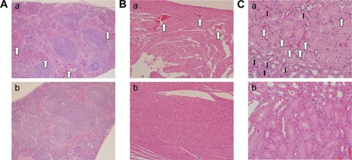 Figure 5 Histological observation of splenic (A), cardiac (B), and nephrotic (C) tissue sections.Notes: Magnifications: (A) 100×; (B) 200×; (C) 400×. (a) Experimental group (35 mg/kg dosage group); (b) control group (saline-treated group). Spleen, heart, and kidney show hyperemia (white arrow), whereas the kidney shows inflammatory cell infiltration (black arrow) in comparison to the control groups.
