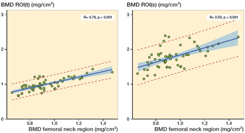 Figure 6. Linear regression analysis of BMD of the femoral neck region versus BMD of ROI(t) and ROI(s), respectively. The shaded area represents the 95% confidence limits and the red broken lines the 95% prediction limits.