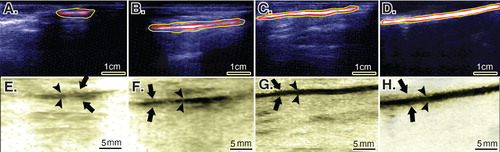 Figure 7. Ultrasonographical characteristics of the injured and normal tendons. Longitudinal sections. A to D are regular ultrasonographs, while E to H are inverted ultrasonographs. Red border (inner border) shows the tendon, while the yellow or outer outline shows the peritendinous adhesions in the healing tendon (A to C) and the paratenon in the normal tendon (D). Arrows head show the tendinous tissue within the defect area or the contralateral part (E to H), while the arrows show the peritendinous adhesions (E to G) and paratenon (H). In the ICTs (A and E), the healing regenerated tissue in the defect area shows hypoechogenicity, irregularity and an amputated echo texture pattern is seen around the tendon. Treatment with CI alone, improved the echogenicity and homogenicity of the healing tendon and also reduced peritendinous adhesion (B and F). Compared to the controls (defect and CI alone), treatment with collagen-platelet implant markedly improved the echogenicity, homogenicity and alignment of the newly developed tendon in the injured area and it also considerably decreased the peritendinous adhesions (C and G). Normal ultrasonographic pattern of the rabbit’s Achilles tendon is provided for comparison (D and H).