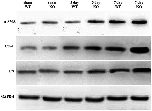 Figure 3. Western-blot result. α-SMA, Col-I and FN protein expression levels were showed. All expressions were normalized to GAPDH. WT, wild-type; KO, SOST knockout.