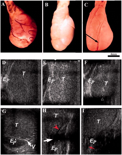 Figure 1. Presenting gross morphology pictures of testis and epididymis and their corresponding ultrasound images taken from various experimental groups. A–C) shows the morphology of testis and epididymis in sham-control, short-term and long-term animals, respectively. Arrow indicates the impression of epididymis on the testis. D) shows the ultrasound images of scrotal content. D–F and G–I) are images along longitudinal and transverse plains, respectively. Arrow and arrow head (red) in H indicates dilated mediastinum and epididymis, respectively. Arrow indicates dilated epididymis in I. T: testis; Ep: epididymis; V: vas deferens.