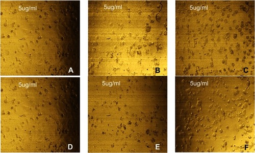 Figure 5 (A–F) Inverted microscope images revealing the effect of 5 µg/mL of each of (A) free CUR (dark), (B) PE3 (dark), (C) GE3 (dark), (D) free CUR (light), (E) PE3 (light) and (F) GE3 (light) on MCF-7 cell line (magnification power 40X).