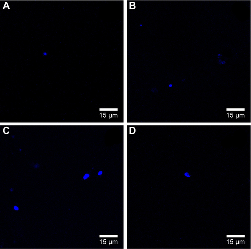 Figure S1 Confocal microscopy images of the evaluation of the auto-fluorescence of the AuNSTs in water or DMEM, with or without the Hoechst stain.Notes: Confocal microscopy images with 352 nm laser excitation of AuNSTs clusters (A) in HEPES buffer, (B) in HEPES buffer with Hoechst 33258, (C) in DMEM and (D) in DMEM with Hoechst 33258.Abbreviations: AuNST, gold nanostar; AuNF, gold nanoflower; HEPES, 4-(2-hydroxyethyl)piperazine-1-ethanesulfonic acid; DMEM, Dulbecco’s Modified Eagle’s Medium.