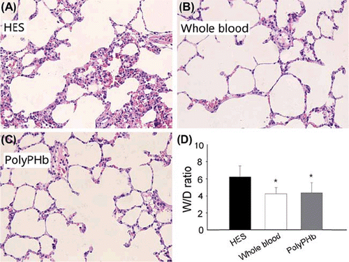 Figure 3. A-D, Representative photomicrographs of H&E-stained left lung tissue sections (40x) harvested after 2 h of resuscitation. E, the W/D ratio of the three groups. Values were presented as mean ± SD (n = 15–18). *P< 0.05 vs. the HES group. H&E: Hematoxylin and Eosin; W/D ratio: the ratio of wet weight/dry weight.