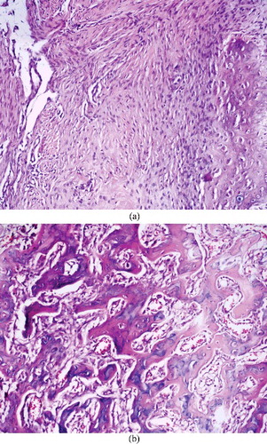 Figure 4. (a) Histopathological images of the samples from a rabbit in the control group with bone healing score 2 and (b) a rabbit in the experimental group with bone healing score 8.