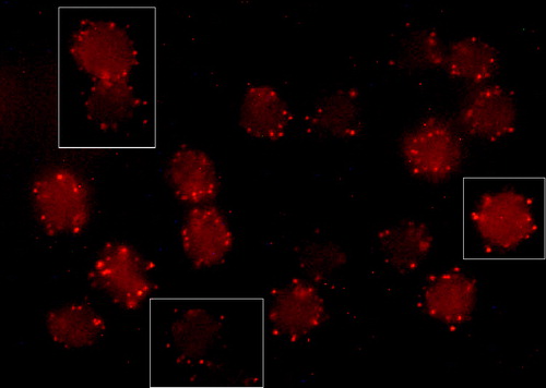 Figure 3.  Fluorescence micrograph (mid-plane cross-section) with insets showing echinocytic human erythrocytes treated with CTB plus anti-CTB. Cells were incubated with A23187 (2 µM, 20 min, 37°C) plus calcium to induce echinocytosis. Cells were fixed with PFA (5%) and GA (0.01%).