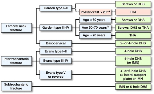 Figure 2. Protocol for implant choice based on fracture type and patient age.