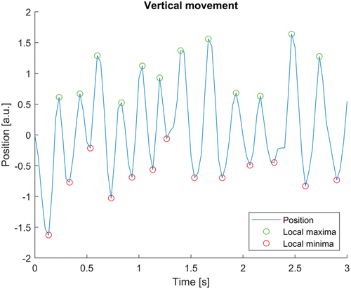 Figure 4. Analysis of video recordings from an affected family member, showing an upbeat nystagmus with variable amplitude and frequency.