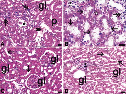 FIGURE 4. Light microscopy of kidney in the diabetes (A, B) and sepsis group (C, D). gl, glomerulus; p, proximal tubules; asterisk, reduced glomerulus; underlined asterisk, inflammatory cell infiltrations at nodular form; arrow, proximal tubules with apical degenerations; arrow with double head, inflammatory cell infiltrations at diffuse form; asterisk with white filling, proximal tubule with integrity loss; arrow head, eosinophilic accumulations in intertubular area; dye: hematoxylin–eosin; magnification bars: 40 μm.