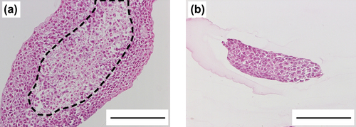 Figure 5. Hematoxylin and eosin-stained sections of the cell aggregates formed in thick (a) and thin (b) microfibers. The area surrounded by dotted-line in (a) is the necrotic region. Bars represent 200 μm.