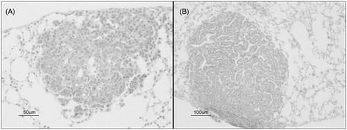 Figure 6. Urethane-induced benign lung tumors in mice treated during 11-week period with urethane (1 mg/g), via once-weekly IP injection. (A) Mixed sub-types adenoma. Bar = 50 µm. (B) Papillary adenoma. Bar = 100 µm.