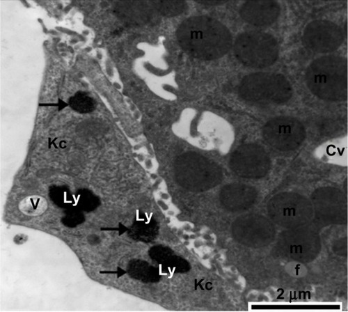 Figure 19 Transmission electron micrograph of a hepatic cell from the treatment group containing a small fat globule and numerous vesicles, fragmented cisternae of rough endoplasmic reticulum, and numerous mitochondria. Also shown is part of a Kupffer cell containing membranous cytoplasmic vacuoles and lysosomes along with electron-dense silver nanoparticles (arrows). Scale bar 2 μm.Abbreviations: Cv, cytoplasmic vacuoles; f, fat globule; Kc, Kupffer cell; Ly, lysosomes; m, mitochondria; V, vesicles.