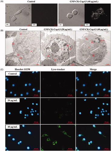Figure 2. Cellular uptake and localisation of GNP-CK-CopA3. (A) EDF images of RAW264.7 cells after incubation with 40 μg/mL GNP-CK-CopA3 for 3 h. (B) TEM images of RAW264.7 cells after 2 h treatment of 20 and 40 µg/mL GNP-CK-CopA3. (C) Staining analysis for detection of the lysosome (green) and nucleus (blue) in RAW264.7 cells by Lyso-Tracker and Hoechst 33258 staining. All treatments were performed three times (n = 3).
