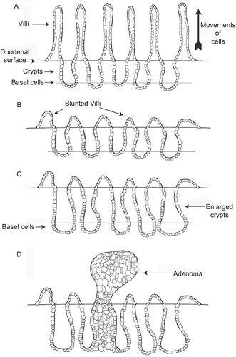 Figure 7.  Diagrams illustrating the sequence of events in folpet-induced duodenal tumors. (A) Simplified diagram of normal duodenum showing normal crypt and villous structures. (B) Folpet-induced damage of duodenum with blunting of the villi and widening of the crypts. (C) Enlargement of crypts in response to duodenal damage, associated with increased proliferation and number of crypt cells. (D) Proliferation of crypt cells leading to development of adenoma, the precursor lesion for adenocarinoma.