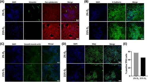 Figure 3. Recovered cells were characteristic of epithelial progenitor cells. Immunofluorescence images of donor 1 cells at recovery (P0). Cells had a widespread expression of the epithelial markers pan-cytokeratin (A) and E-cadherin (B) and minimal expression of vimentin (A) or smooth muscle actin (C). Cells were also frequently, but not universally, positive for the basal cell marker TP63 (D). Scale bar: 100 µm. Immunofluorescence images are counterstained with DAPI to identify nuclei. (E) Quantification of TP63 expression via image analysis.