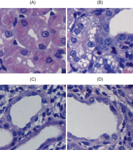 FIGURE 2. General pathological changes caused by UUO (HE staining). (A) No abnormal changes were detected in sham-operated rats. (B) At 3d after UUO, inflammatory cell infiltration and tubular edema appeared. (C) In UUO group, renal tubular dilation was observed at 7d after obstruction. Visible renal interstitial edema, monocyte and lymphocyte infiltration appeared at tubulointerstitial region. (D) In UUO group, renal tubular structure was severely damaged at 14d after obstruction, that is, collapsed lumen, diffusive infiltration of fibroblast in renal interstitium, and collagen formation. Original magnification ×400.