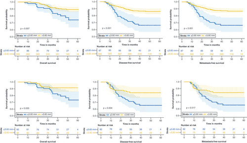 Figure 5. Pre- and post-propensity score matched Kaplan–Meier analysis survival curves for overall survival, disease-free survival and metastasis-free survival.The first row shows the survival curve prior to propensity score matching.SRV: Superior rectal vein.