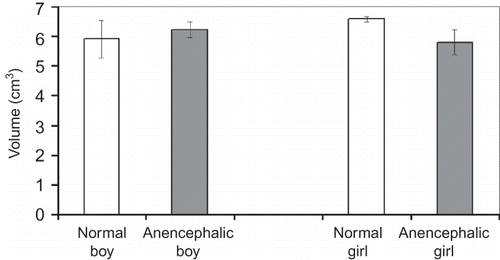 Figure 7. Kidney volume estimation using Cavalieri principle for normal and anencephalic fetuses (mean ± SEM).