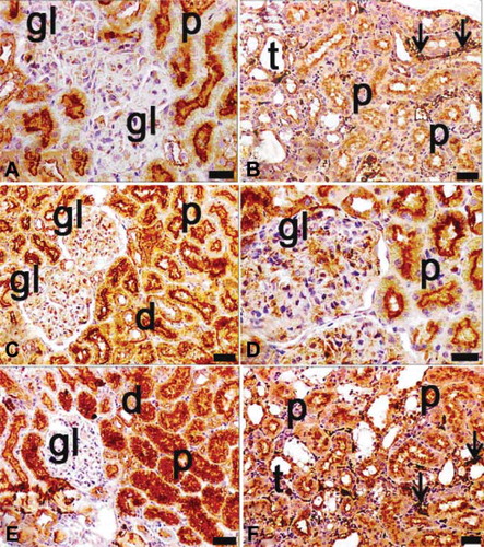 FIGURE 8. Immunohistochemical staining of NF-κB (p65) in tissue sections of ovariectomy–diabetes (A, B), ovariectomy–sepsis (C, D), and diabetes–sepsis (E, F) groups. gl, glomerulus; d, distal tubules; p, proximal tubules; t, collecting tubules; arrows indicate extramesangial cells with p65 positive nuclei and cytoplasm; positivity was seen in especially cytoplasmic pattern of tubular cells, both cytoplasmic and nuclear pattern of extramesangial cells and rarely in glomeruli. The most expression of p65 was found in diabetes–sepsis group; magnification bars: 30 μm.