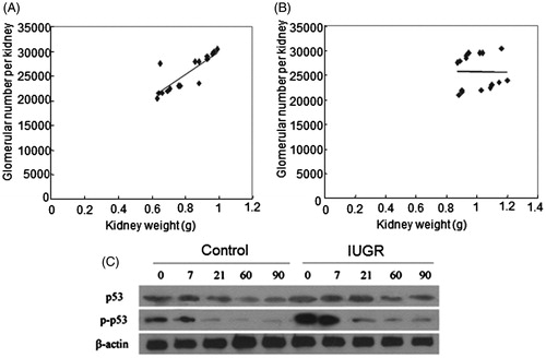 Figure 2. Correlations between kidney weights and glomerular numbers and Western blot of p53 and p53 Ser15 protein expression. Correlations between kidney weights and glomerular numbers at 2 months (A) and 3 months (B) after birth. Significant correlation between kidney weight and glomerular number of the right kidney was observed at 2 months of age (r = 0.842, p = 0.000) (A), but not at 3 months of age (r = −0.016, p = 0.953) (B). Correlation analysis included samples from two groups at the same time point. N = 16. (C) Western blot of p53 protein expression and p53 phosphorylation at serine 15. β-Actin was used as a loading control. 0, 7, 21, 60 and 90 represent at birth, 7th day, 21st day, 60th day and 90th day after birth.
