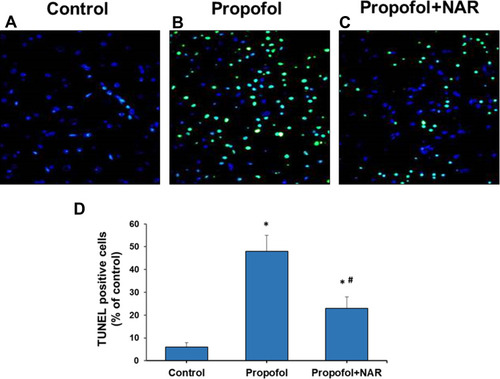 Figure 3 Apoptosis measurement by TUNEL staining of brain cortex slices from neonatal mice. (A) control group; (B) propofol treatment group; (C) propofol+naringenin. (D) Quantitative expression of TUNEL positive staining. *P<0.05 versus control group; #P<0.05 versus propofol group.