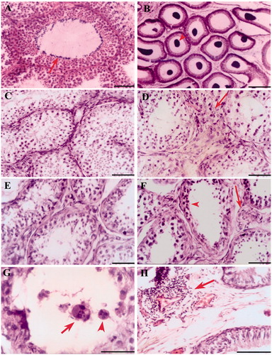 Figure 2. Photomicrograph of testis and epididymis stained with hematoxylin and eosin taken from various experimental groups. (A and B) shows the photomicrographs of testis (complete spermatogenesis - arrow) and epididymis (sperm accumulation - arrowhead) from sham-operated control. (C and D) are testis from short-term, and (E and F) are from long-term of unoperated and operated sides testes, respectively. The arrows in D and F indicate sites of germ cell leakage and hypertrophic changes in the interstitium. The arrowhead indicates depleted epithelium (F). (G) shows a seminiferous tubule taken from long-term animal with multinucleated giant cells, a large cell with multiple nucleuses with vacuole (arrow), and another cell with interconnected four distinct nucleuses (arrowhead). (H) a site of infiltration or inflammatory reaction around a capillary (vacuities like change) in epididymal interstitium from long-term animal was shown (arrow). Scale bar = 80 µm.