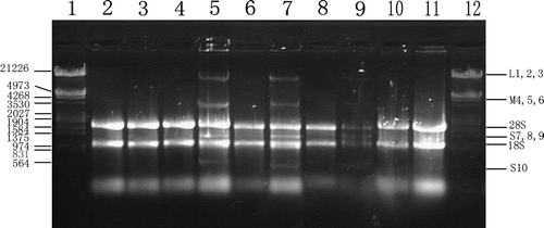 Figure 3.  Gel electrophoresis of total RNA extract from different cell lines infected with BTV-10 36 h post infection. Lane 1. DNA Markers (λ DNA digested with Eco RI +Hind III); Lane 2. Total RNA extract from mock HEL cells; Lane 3. Total RNA isolated from BTV-10 infected HEL cells; Lane 4. Total RNA extract from mock A549 cells; Lane 5. Total RNA isolated from BTV-10 infected A549; Lane 6. Total RNA extract from mock Hep-3B cells; Lane 7. Total RNA isolated from BTV-10 infected Hep-3B; Lane 8. Total RNA extract from mock NIH3T3 cells; Lane 9. Total RNA isolated from BTV-10 infected NIH3T3; Lane 10. Total RNA extract from mock MEF cells; Lane 11. Total RNA isolated from BTV-10 infected MEF; Among all the lanes cellular ribosomal 28S and 18S rRNA could be seen, while only in 5, 7 and 9 lanes the three groups of BTV viral RNA bands (L M & S) could be detected.