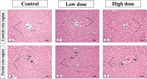 Figure 4. Illustrative photographs displaying the effect of low and high doses (100 and 200 mg/kg, respectively). MgO-zein nanowires on liver histopathology in male rats (H & E stain × 200). Control group (A,B) showed A: normal central vein (CV), hepatocyte cell cords (black arrows), separated by narrow sinusoids (white arrows), cell nuclei are rounded and vesicular; B: normal portal area contents [bile duct (BD), hepatic artery (HA), and branches of portal vein (PV)]. Low dose group (C,D) showed (C) normal hepatic architecture with the normal central vein (CV) and hepatocyte cell cords (arrows), blood sinusoids showed slight dilation (white arrows) with prominent Kupffer cells (dotted arrows); (D) Slight congestion and dilatation of portal vein (PV), the proliferation of bile ducts (BD) and slight proliferation of connective tissue were seen in the portal area (white star) while nearby hepatocytes showed active vesicular nuclei (arrows). High dose group (E,F) showed (E) no alteration of hepatic parenchyma normal slightly dilated central vein (CV), normal hepatocytes with active nuclei (black arrows), prominent Kupffer cells (dotted arrows); (F) portal area showed proliferation of bile duct (BD) and slight congestion of portal veins (PV), besides vessel congestion with an increase in periductal connective tissue (stars) while nearby hepatocytes showed active vesicular nuclei (arrows).