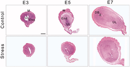 Figure 3. The dynamic structure of the uterus during mouse embryo implantation. Under an optical microscope with 40× objective, the uterine transverse section is oval-shaped and consists of three outside-in histological elements: the perimetrium, the myometrium and the endometrium. The myometrium contains an inner circular layer and an outer longitudinal layer of smooth muscle. In addition, a vascular layer is located between the muscle layers. On E7, the embryo and the decidual area are shown in the uterine section. DB: Decidua basalis; E: Embryo; End: Endometrium; E3: Embryonic day 3; E5: Embryonic day 5; E7: Embryonic day 7; M: Mesometrium; UL: Uterine lumen. Bar = 500 μm.