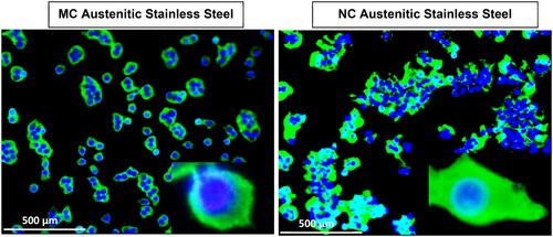 Figure 5. Fluorescence micrographs representing immunocytochemistry of fibronectin expressed by fibroblasts after incubation for 2 days on (a) MC and (b) NC stainless steel surface. A higher fluorescence intensity and expanded network of fibronectin expression along with a higher cell density is observed labelling of cell nuclei with DAPI. Inset is the magnified view of the cell (adapted from references 3, 37, 40).