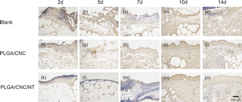 Figure 7. The expression of IL-6 in dorsal skin after full-thickness wounds in diabetic mice. The bar corresponds to 100 μm.