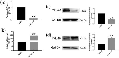 Figure 2. RT-qPCR and Western blot determined the expression of YKL-40 mRNA and proteins in HTR-8/SVneo after YKL-40 was knocked down or overexpressed, respectively (**P < 0.01). (a) RT-qPCR showed the mRNA levels of knocked out YKL-40 (**P < 0.01, si-NC vs. si-YKL-40). (c) Western blot indicated protein levels of knocked out YKL-40 (**P < 0.01, si-NC vs. si-YKL-40). (b) RT-qPCR displayed mRNA levels of overexpression of YKL-40 (**P < 0.01, OE-NC vs. OE-YKL-40). (d) Western blot demonstrated protein levels of overexpression YKL-40 (**P < 0.01, OE-NC vs. OE-YKL-40).