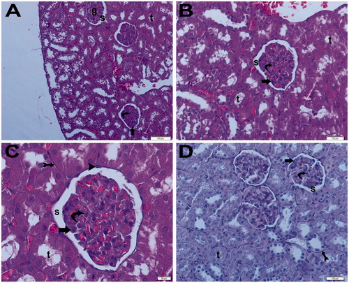 Figure 15. (Ischemia/reperfusion + aliskiren 100 mg/kg) (A) Light microscopy of a glomerulus (g) demonstrating normal glomerular structure and typical podocyte (arrow), mesangial cell (curved arrow). Typical capsular space (s). Normally tubular structure (t). H&E stain. (B) Light microscopy of a glomerulus demonstrating normal glomerular structure and typical podocyte (arrow), mesangial cell (curved arrow). Typical capsular space (s). Normally tubular structure (t). H&E stain. (C) Light microscopy of a glomerulus demonstrating normal glomerular structure and typical podocyte (arrow), mesangial cell (curved arrow). Typical capsular space (s) and normally tubular structure (t). Tubular basement membrane appears clear (tail arrow). Typical parietal epithelial cell (arrow head) H&E stain. (D) Light microscopy of a glomerulus demonstrating normal glomerular structure and typical podocyte (arrow), mesangial cell (curved arrow). Typical capsular space (s) and normal tubular structure (t). Tubular basement membrane appears clear (tail arrow). PAS stain.