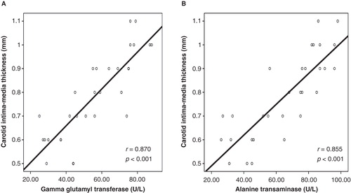 Figure 2. In patients with non-alcoholic steatohepatitis, serum gamma glutamyl transferase and alanine transaminase concentrations were highly correlated with the carotid intima-media thickness. A: Graphics showing correlation between serum gamma glutamyl transferase concentration and carotid intima-media thickness. B: Graphics showing correlation between serum alanine transaminase concentration and carotid intima-media thickness.