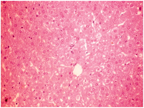 Figure 4. CCl4 + MERV-200 mg/kg-treated group rat liver section showing typical lobular arrangement.
