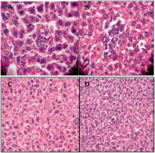Figure 1. A and B: H&E staining of liver tissues isolated from CCl4-exposed rats demonstrates focal hepatocyte necrosis, as well as, increased infiltration of the inflammatory cells into the portal tract in the APAP-induced hepatotoxic mice; Fatty degeneration and central vein dilation were obvious (magnification ×400). C and D: No hepatocellular necrosis and APAP-induced damage was observed in metformin (200 mg/kg)- and NAC (100 mg/kg)-treated mice (magnification ×200).