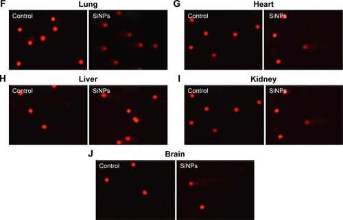 Figure 4 Effect of SiNPs on DNA migration in various organs.Notes: DNA migration in the lung (A), heart (B), liver (C), kidney (D), and brain (E) tissues 24 hours after the administration of amorphous SiNPs (0.25 mg/kg) in mice. Data are mean ± SEM (n=5). Images illustrate the quantification of the DNA migration by the comet assay under alkaline conditions in the lung (F), heart (G), liver (H), kidney (I), and brain (J) tissues. The magnification in F–J is 20×.Abbreviations: SiNPs, silica nanoparticles; SEM, standard error of the mean.