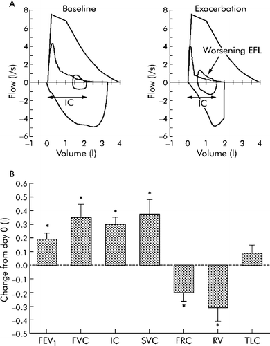 Figure 5 Magnitude of change in lung function parameters during recovery from exacerbation. (A) Representative flow-volume loops from a patient obtained at baseline (that is, before the exacerbation) and after onset of symptoms compatible with exacerbation. During exacerbation there is evidence of worsening expiratory flow limitation (EFL, arrow) resulting in hyperinflation with an increased end expiratory lung volume (EELV) and reduced inspiratory capacity (IC). (B) Change in lung function parameters during recovery from moderate exacerbations in 20 patients. Subjects were studied (day 0) within 72 hours of symptomatic deterioration. Data shown are change from initial (day 0) assessment. A bbreviations: FEV1 = forced expiratory volume in 1 second; FVC = forced vital capacity; IC = inspiratory capacity; SVC = slow vital capacity; FRC = functional residual capacity; RV = residual volume; TLC = total lung capacity. From reference 34, with permission.