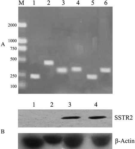 Figure 1.  The expression of SSTRs in capan-2 and A549 cells. A: The RNA expressions of all five SSTRs were analyzed by RT-PCR. SSTR1 (lane 1), SSTR2 (lane 2), SSTR4 (lane 3) and SSTR5 (lane 4) were expressed in capan-2 cells while SSTR1 (lane 5) and SSTR3 (lane 6) were expressed in A549 cells. DNA ladders were loaded in lane M.B: The protein expression of SSTR2 was detected in capan-2 (3) and A549 cells (4) transfected with Adv-SSTR2, shown by western blotting with anti-SSTR2. No SSTR2 proteins were detected in control capan-2 (1) cells or A549 (2) cells transfected with Adv-LacZ. The cellular β-actin was shown as an internal control.