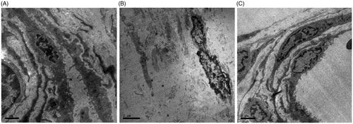 Figure 4. Effects of PNS on the peritoneum tissue of rats examined by transmission electron microscope. (A) Saline group, (B) Standard PDF group, and (C) PNS group.