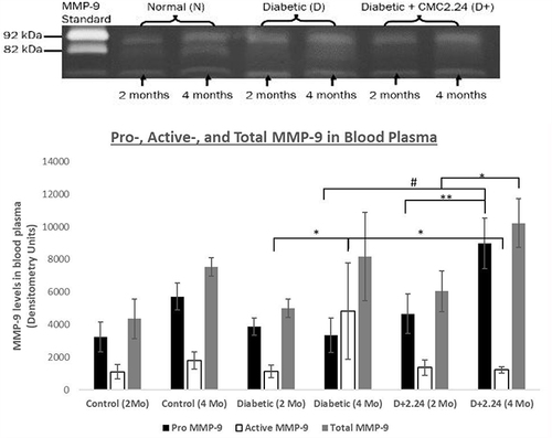 Figure 2 Effect of CMC 2.24 treatment on levels of pro-, activated-and total MMP-9 in blood plasma. STZ-diabetic rats in treatment group were administered daily by oral gavage CMC2.24 (30mg/kg) for 4-months. Blood plasma was collected at 2-months and 4-months. Gelatinase activities were analyzed by gelatin zymography and scanned by densitometer. Black bar: pro-MMP-9 activity; White bar: activated-MMP-9 activity; Gray bar: total-MMP-9 activity. Control (2 Mo): normal group at 2-months; Control (4 Mo): normal group at 4-months; Diabetic (2 Mo): diabetic group at 2-months; Diabetic (4 Mo): diabetic group at 4-months; D+2.24 (2 Mo): diabetes+CMC2.24 group at 2-months; D+2.24 (4 Mo): diabetes+CMC2.24 group at 4-months. Each value represents Mean (n=6-8 rats/group) ± Standard Error (S.E.M.) *Indicates p<0.05; **Indicates p<0.01, #Indicates p<0.0005 values compared between groups at the same time period.