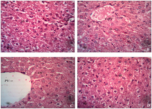 Figure 7. Histopathology of liver of experimental rats. (A) Group I – Normal histology showing hepatocytes (H) and portal triad (PT); (B) Group II – Normal histology showing hepatocytes (H) and portal vein (PV); (C) Group III – Diabetic liver showing dialated sinusoids (DS) and haemorrhage; (D) Group IV – Diabetic liver showing mild degeneration of hepatocytes (H).