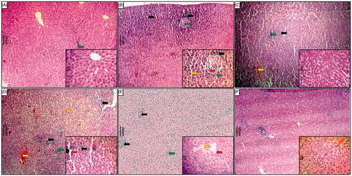 Figure 3. Effect of naringin treatment on APAP-induced pathological alteration in rat liver. Photomicrograph of sections of liver of normal (A), APAP controls (B), silymarin (25 mg/kg) treated (C), naringin (40 mg/kg) treated (D), naringin (80 mg/kg) treated (E) and per se treated (F) rats. Inflammatory infiltration (black arrow), edema (yellow arrow), congestion (green arrow) and necrosis (red arrow). H&E staining at 40× and 100 × (inset).