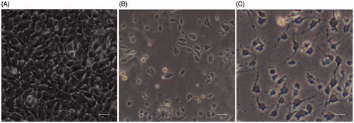 Figure 5. Microscopic images of HaCaT keratinocytes. A, Control cells; B, Cells infected with 3 log CFU/ml PS103 for 2 h; C, Cells treated with L-Pch-CPM for 24 h killed the bacterium with reduced toxicity. Scale bar, 50 µm.